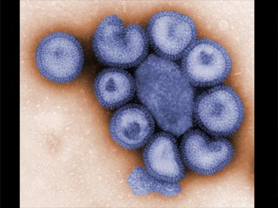Photo of Influenza